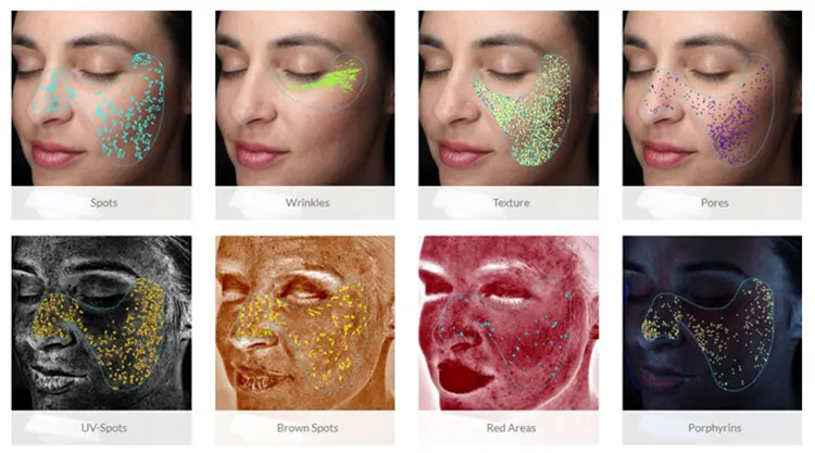 skin analyzer detail Application.webp