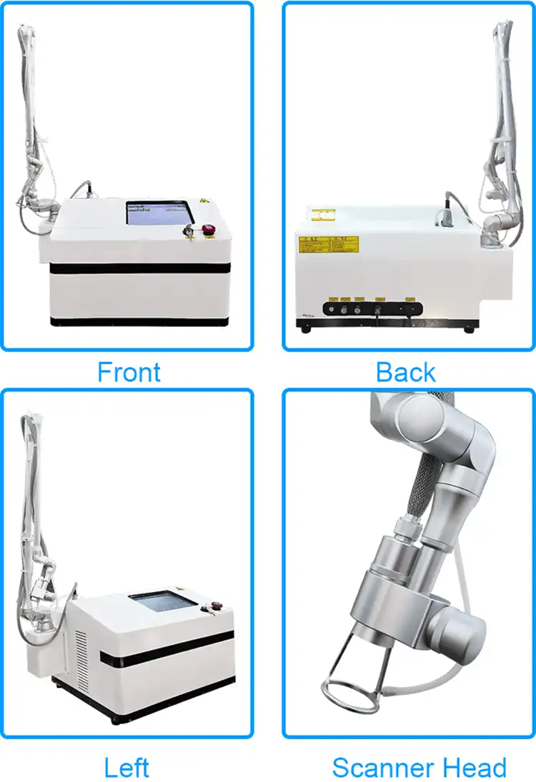 fractional co2 laser detail 5.webp